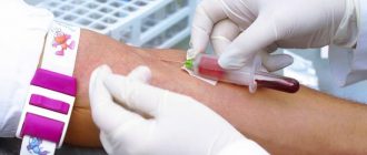 Taking blood from a vein for analysis