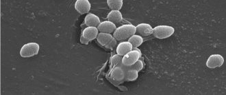 Enterococcus under a microscope