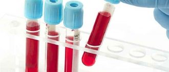 Test tubes with blood for analysis