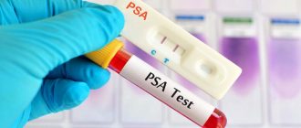 Blood sample for PSA test